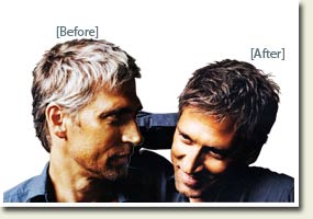 Homme Before and After
